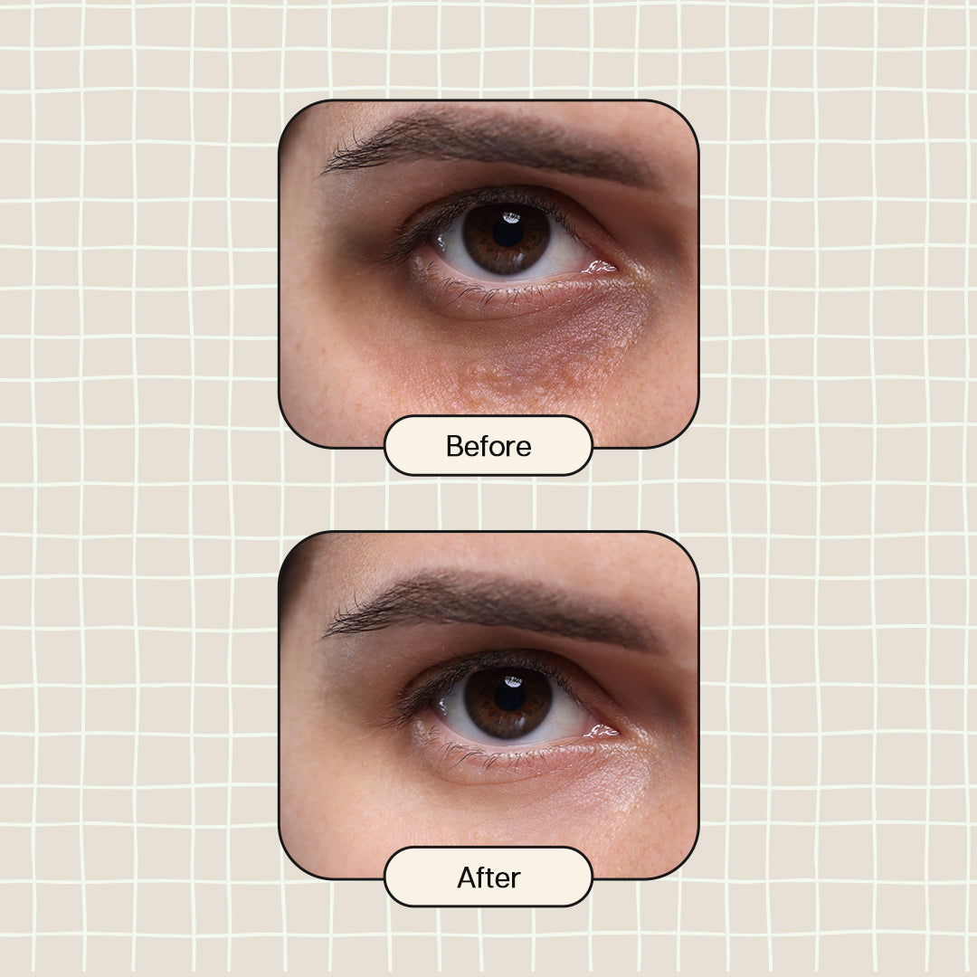 Lashfactor Under Eye Gel Serum - Reduces Dark Circles, Puffy Eyes & Eye Bags | Scientifically Proven | 100% Vegan | 30g